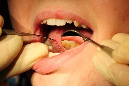 Call for urgent action over lack of West Somerset dentists