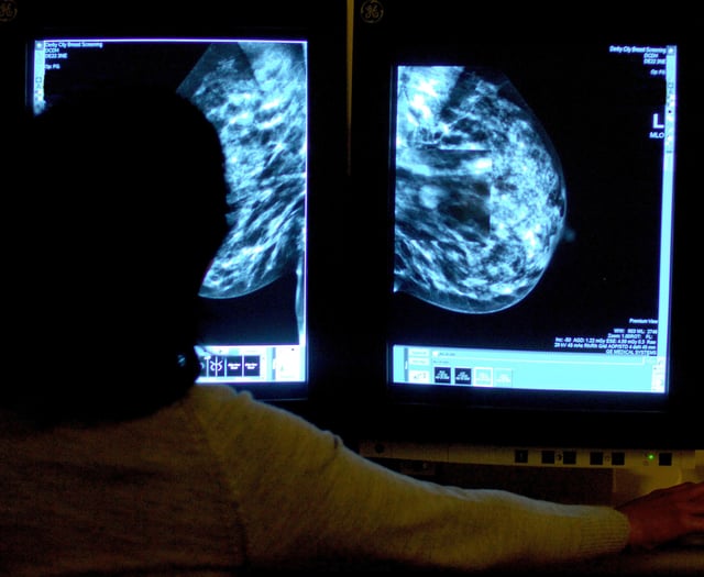 Hundreds of 'missing' cancer diagnoses in Somerset in 2020 – as fewer found at early stage