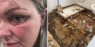 Disabled mother left black and blue after floor and ceiling collapse